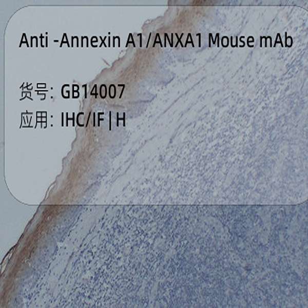 Антитела первичные, моноклональные, Annexin A1/ANXA1, 50 мкл