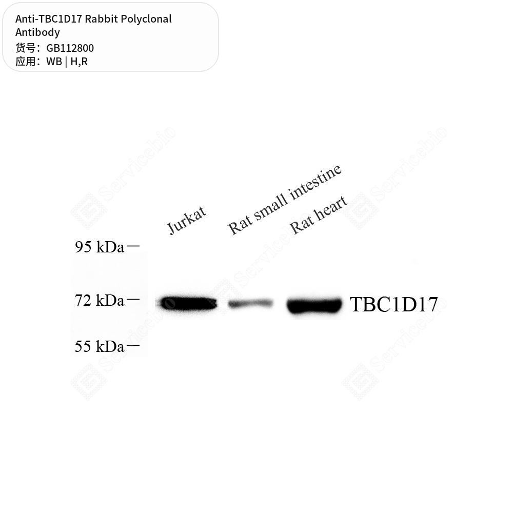 Антитела первичные, поликлональные кролика к TBC1D17 крысы, человека, 50 мкл