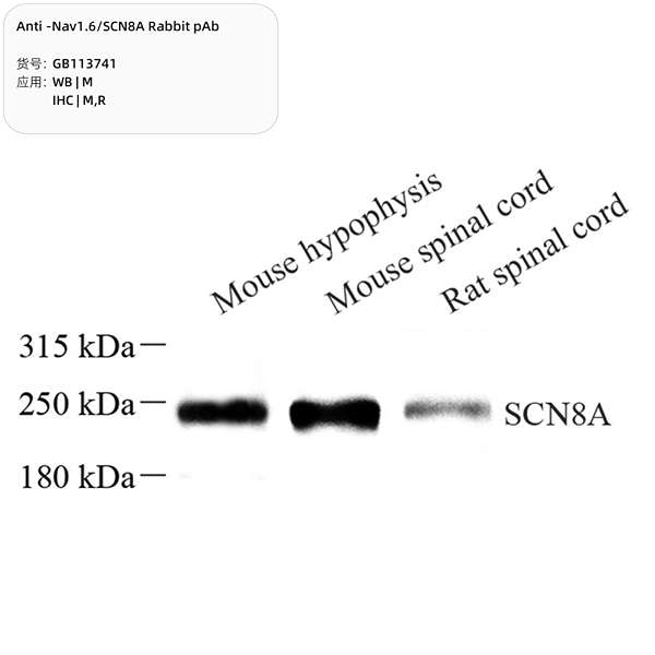 Антитела первичные, поликлональные, Nav1.6/SCN8A, 100 мкл