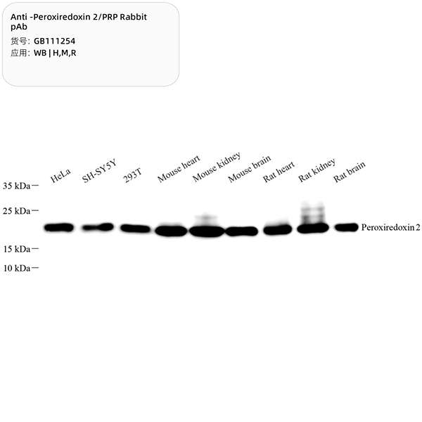 Антитела первичные, поликлональные, Peroxiredoxin 2/PRP, 100 мкл