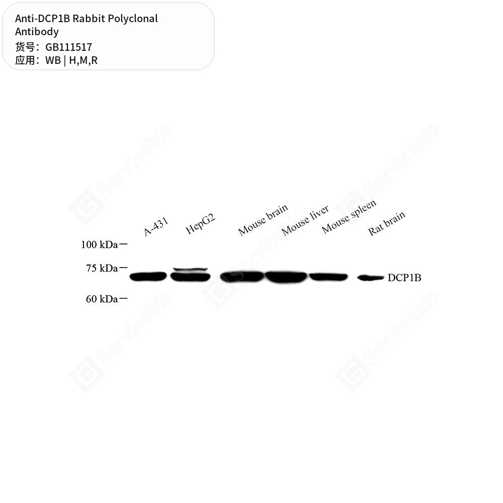 Антитела первичные, поликлональные кролика к DCP1B крысы, мыши, человека, 100 мкл