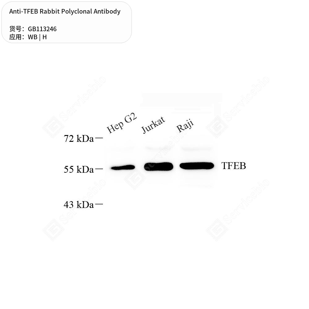 Антитела первичные, поликлональные кролика к TFEB человека, 100 мкл