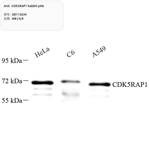 Антитела первичные, поликлональные, CDK5RAP1, 100 мкл