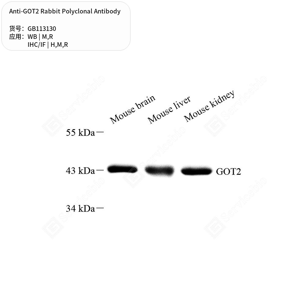 Антитела первичные, поликлональные кролика к GOT2 крысы, мыши, человека, 100 мкл