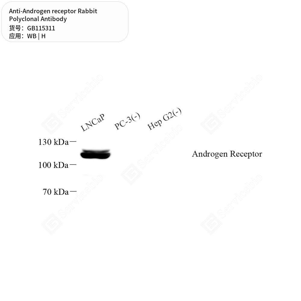 Антитела первичные, поликлональные кролика к Androgen receptor человека, 50 мкл