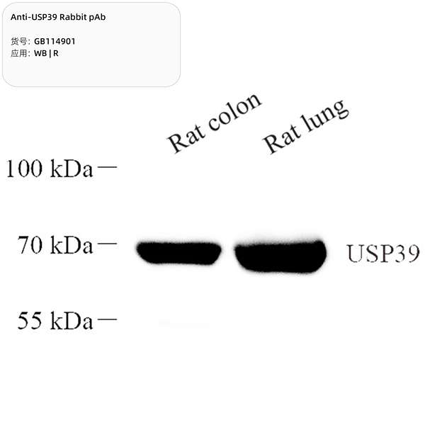 Антитела первичные, поликлональные, USP39, 100 мкл