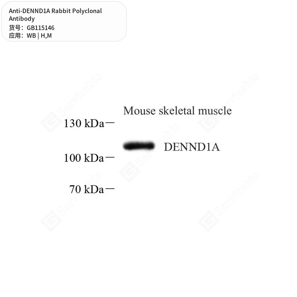 Антитела первичные, поликлональные кролика к DENND1A мыши, человека, 100 мкл