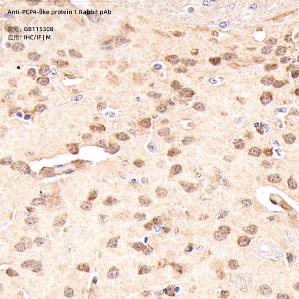 Антитела первичные, поликлональные, PCP4-like protein 1, 100 мкл