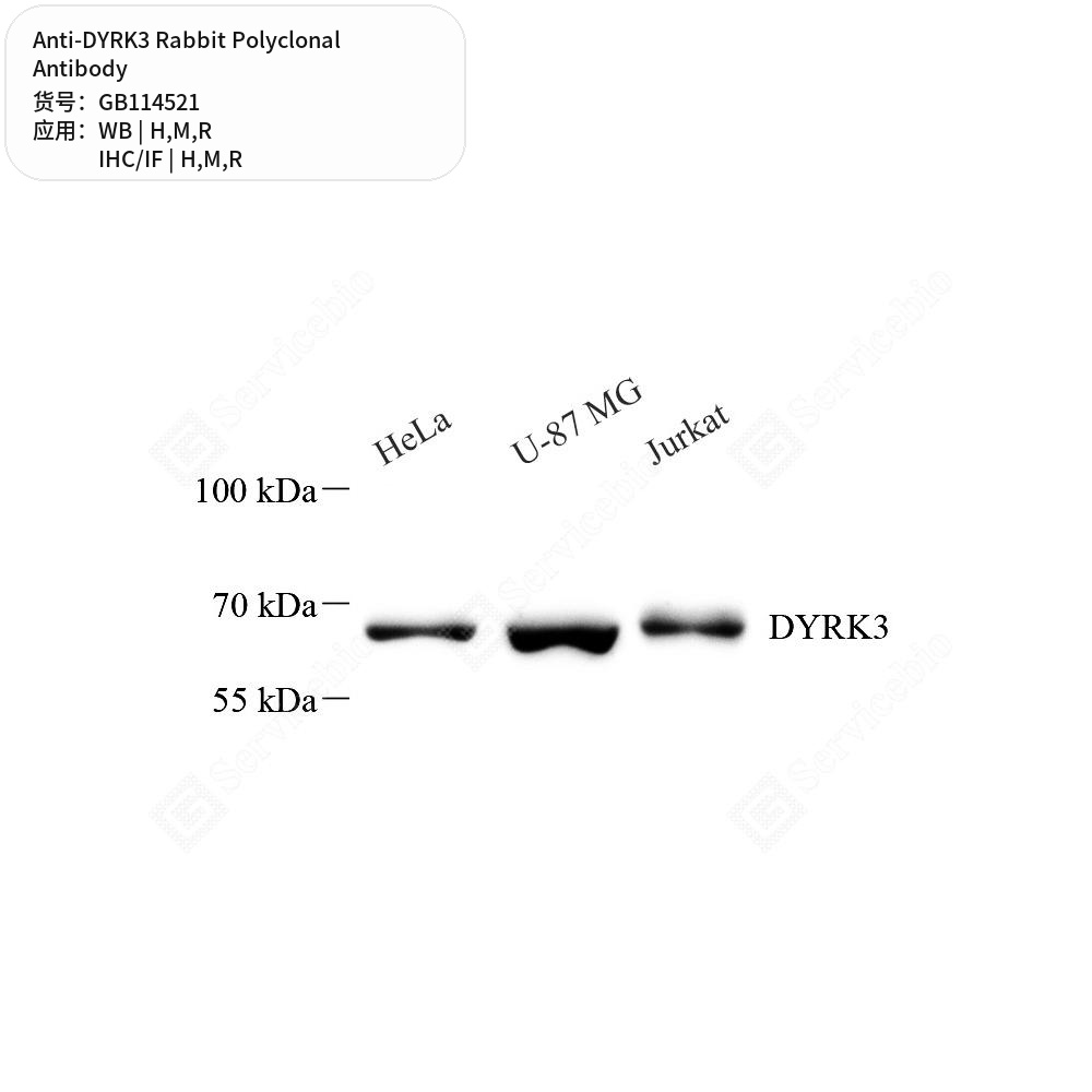 Антитела первичные, поликлональные кролика к DYRK3 крысы, мыши, человека, 50 мкл
