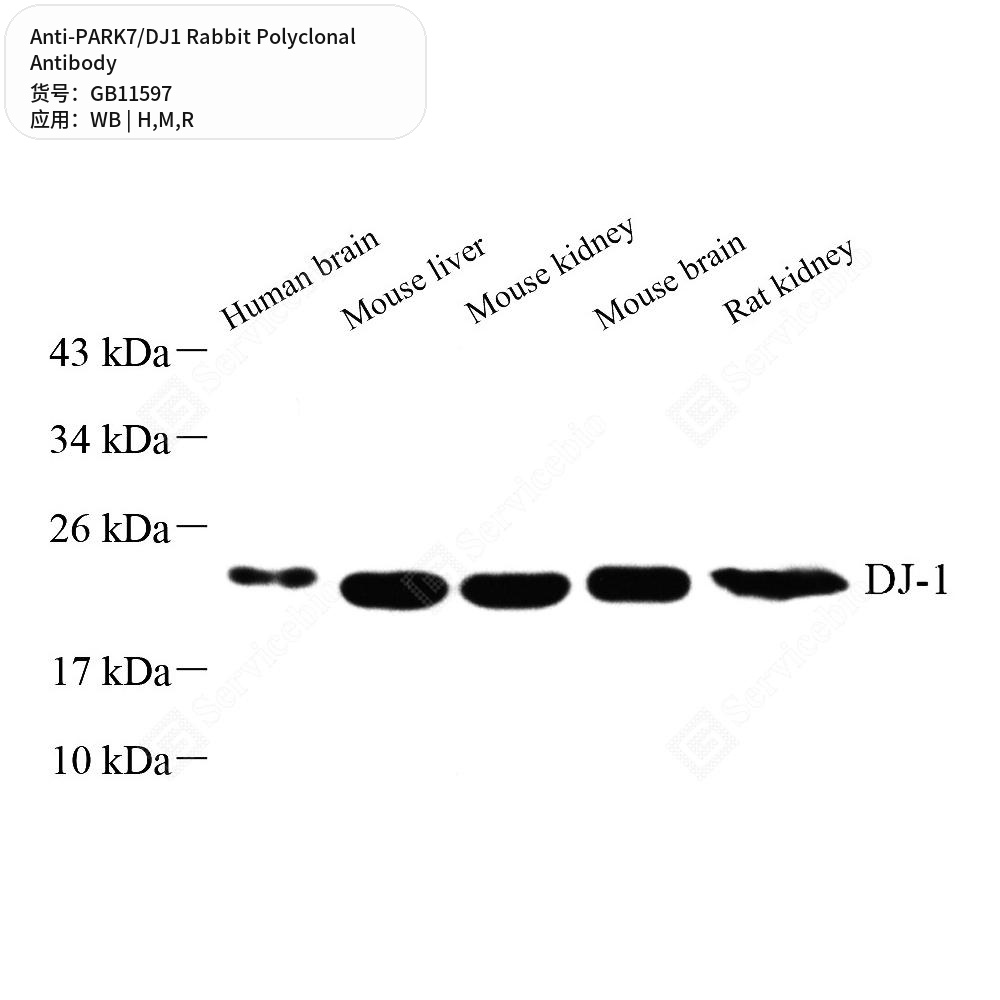 Антитела первичные, поликлональные кролика к PARK7/DJ1 крысы, мыши, человека, 50 мкл