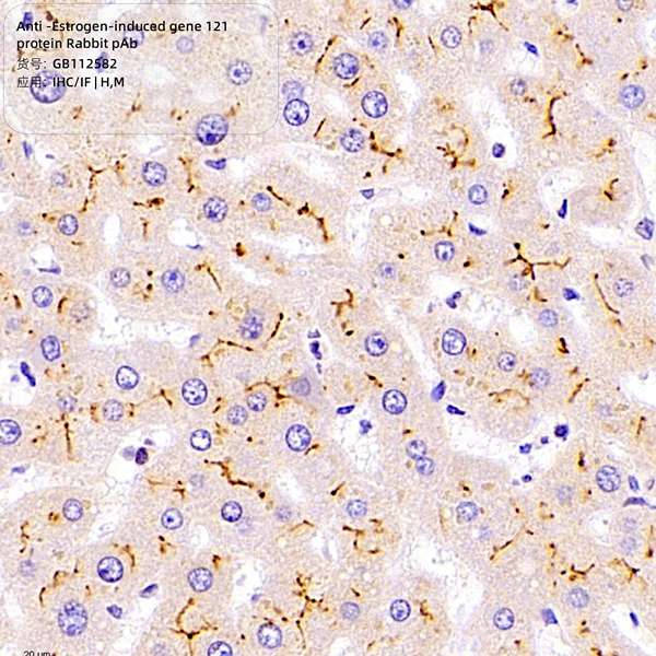 Антитела первичные, поликлональные, Estrogen-induced gene 121 protein, 100 мкл