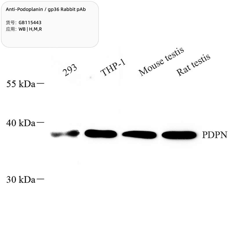 Антитела первичные, поликлональные, Podoplanin/gp36, 100 мкл