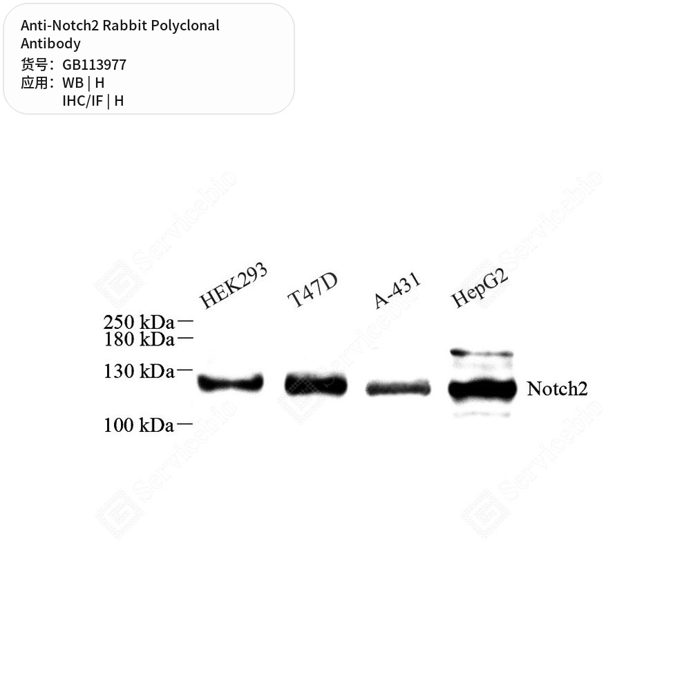 Антитела первичные, поликлональные кролика к Notch2 человека, 50 мкл