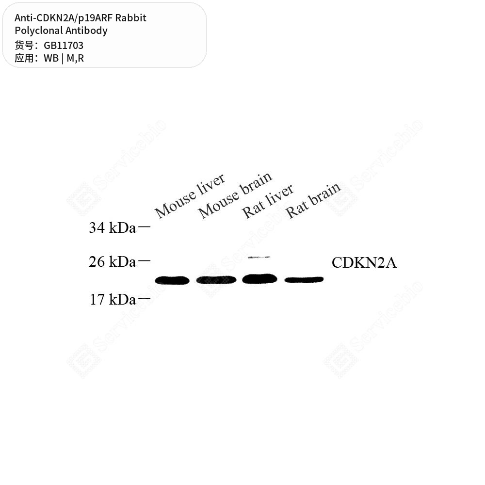 Антитела первичные, поликлональные кролика к CDKN2A/p19ARF крысы, мыши, 50 мкл