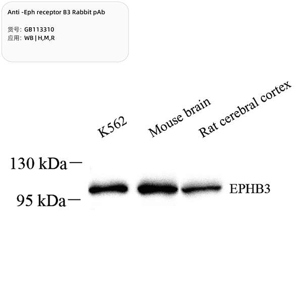 Антитела первичные, поликлональные, Eph receptor B3, 100 мкл