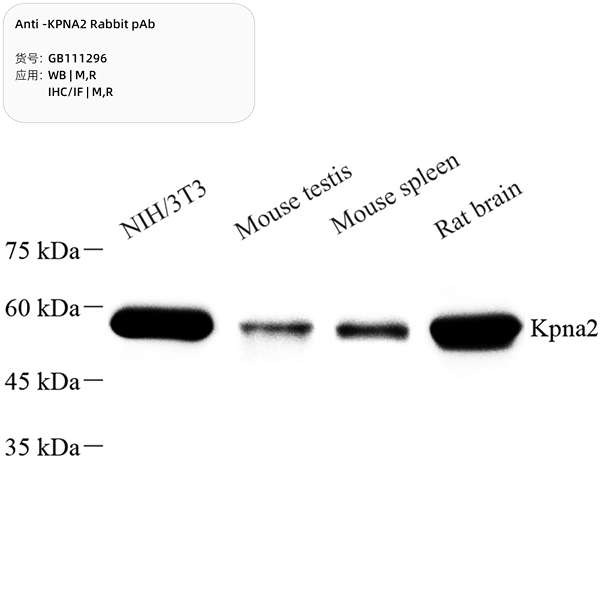 Антитела первичные, поликлональные, KPNA2, 100 мкл