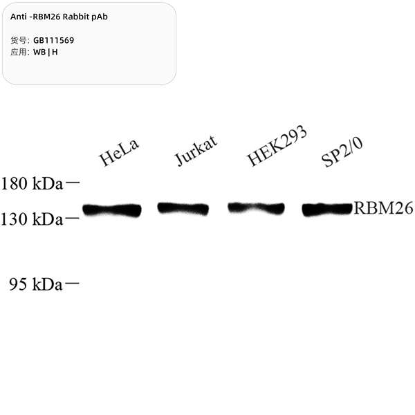 Антитела первичные, поликлональные, RBM26, 100 мкл