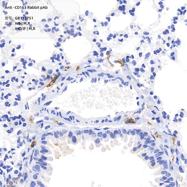 Антитела первичные, поликлональные CD163, 100 мкл