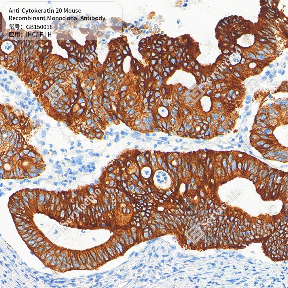 Антитела первичные, моноклональные мыши к Cytokeratin 20 человека, 50 мкл