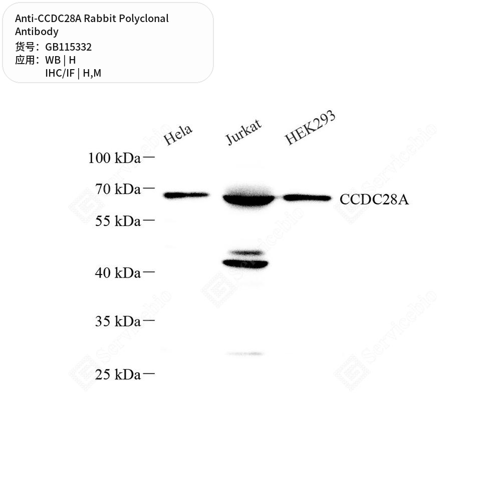 Антитела первичные, поликлональные кролика к CCDC28A мыши, человека, 100 мкл