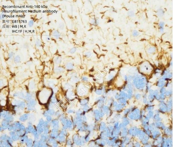 Антитела первичные, моноклональные, 160 kDa Neurofilament Medium, 100 мкл