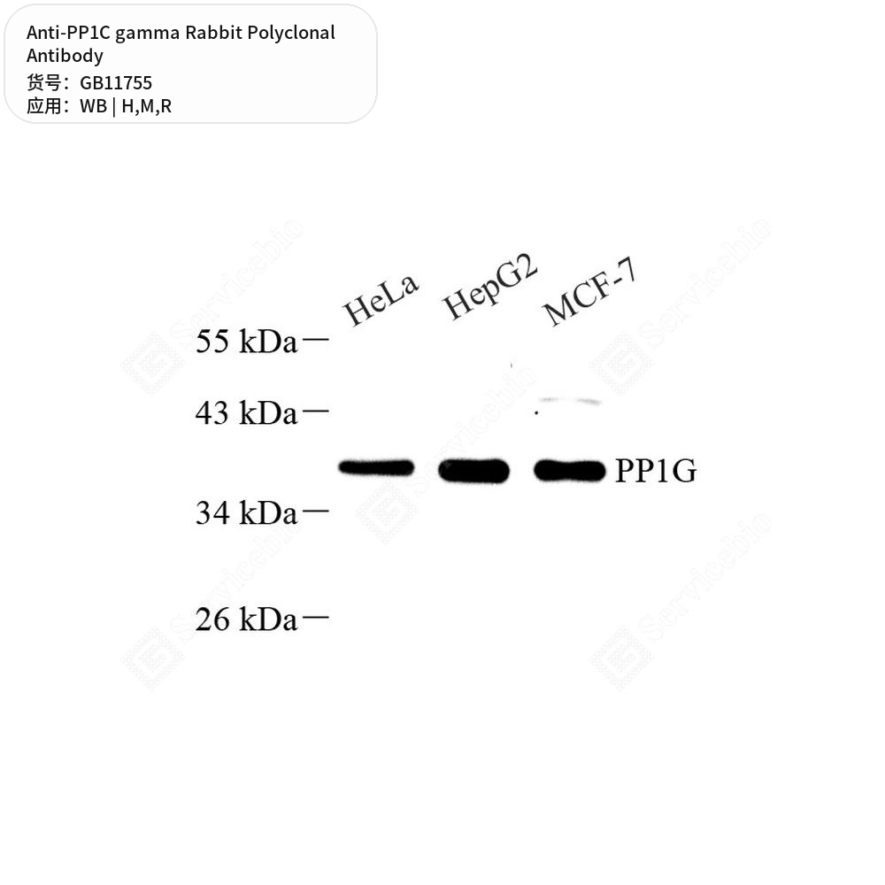 Антитела первичные, поликлональные кролика к PP1C gamma крысы, мыши, человека, 50 мкл