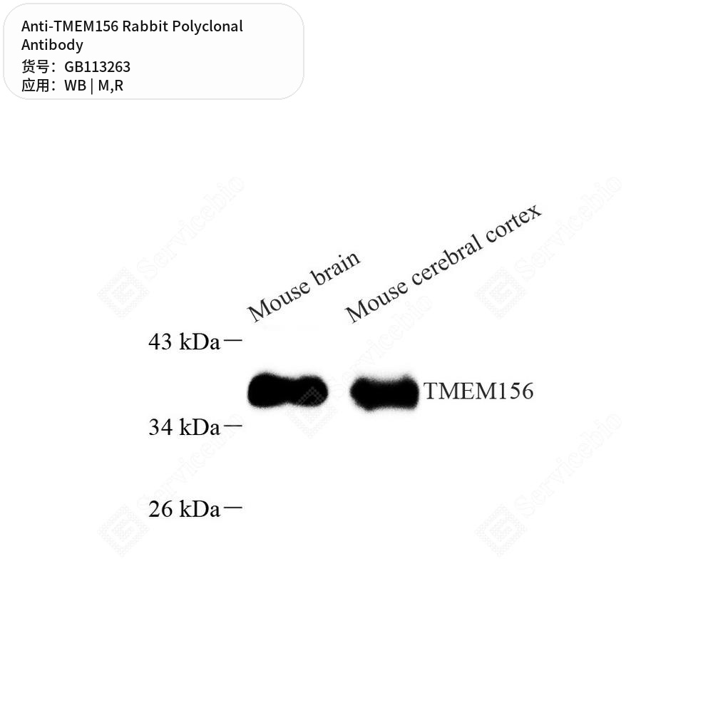 Антитела первичные, поликлональные кролика к TMEM156 крысы, мыши, 100 мкл