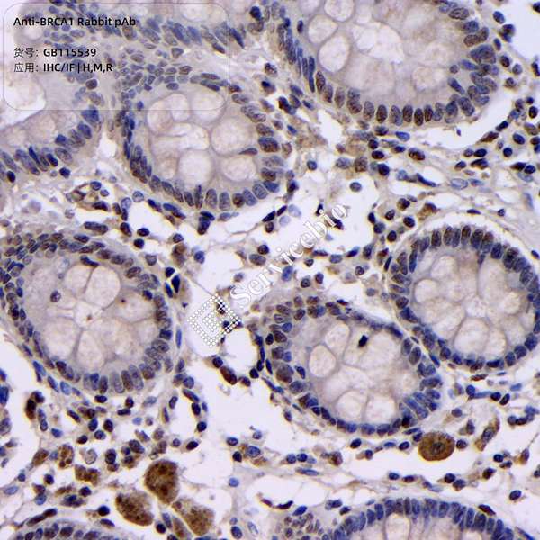 Антитела первичные, поликлональные, BRCA1, 100 мкл