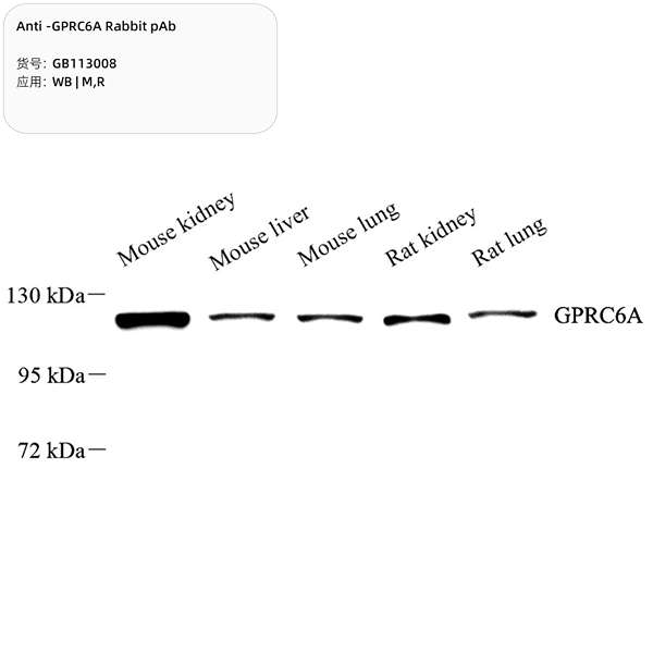 Антитела первичные, поликлональные, GPRC6A, 100 мкл