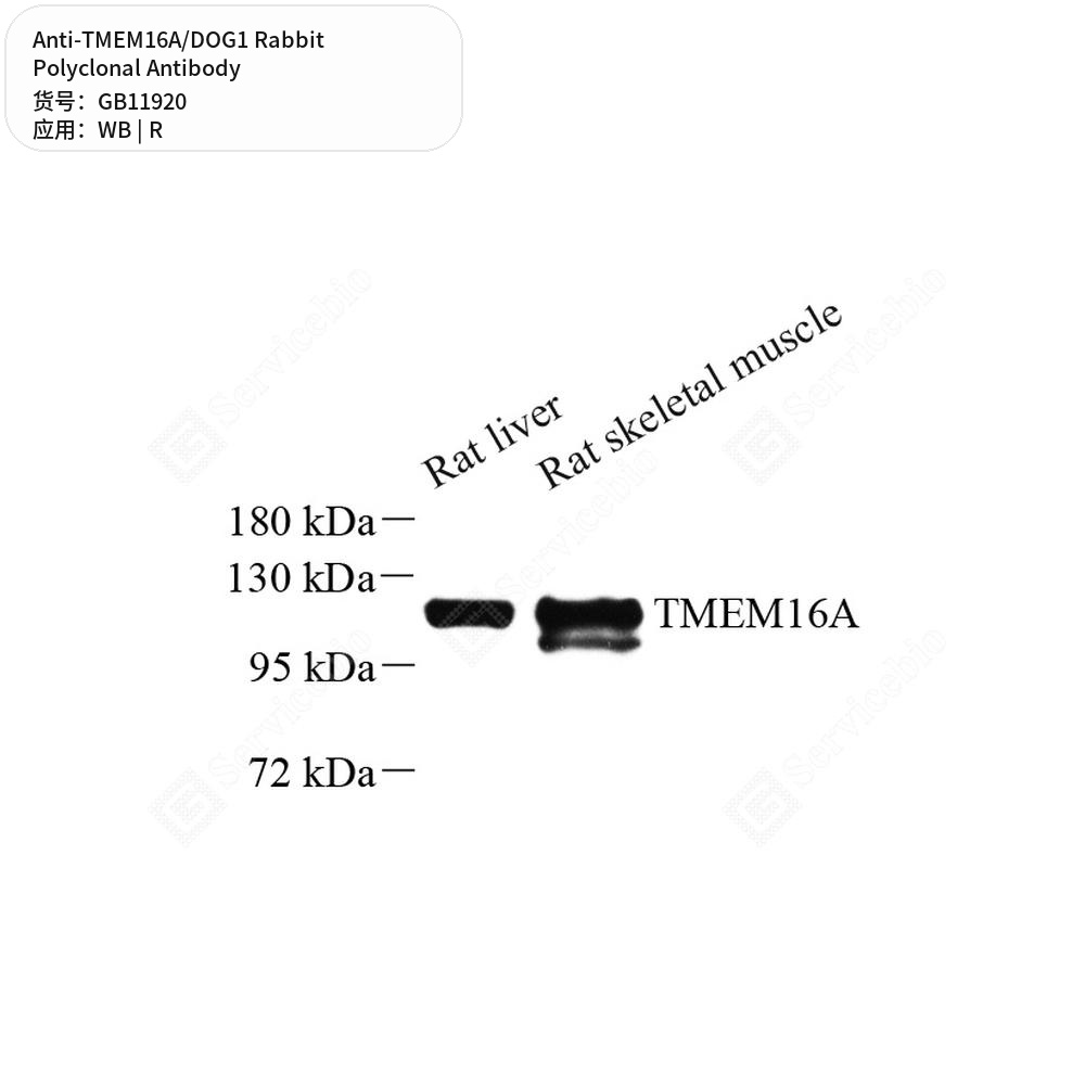 Антитела первичные, поликлональные кролика к TMEM16A/DOG1 крысы, 50 мкл