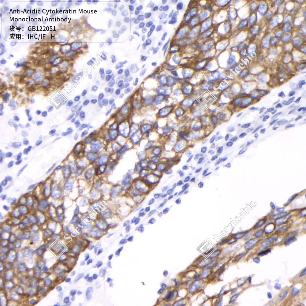 Антитела первичные, моноклональные мыши к Acidic Cytokeratin человека, 100 мкл
