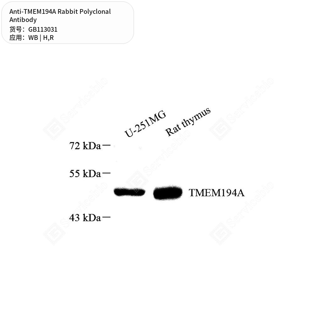 Антитела первичные, поликлональные кролика к TMEM194A крысы, человека, 100 мкл