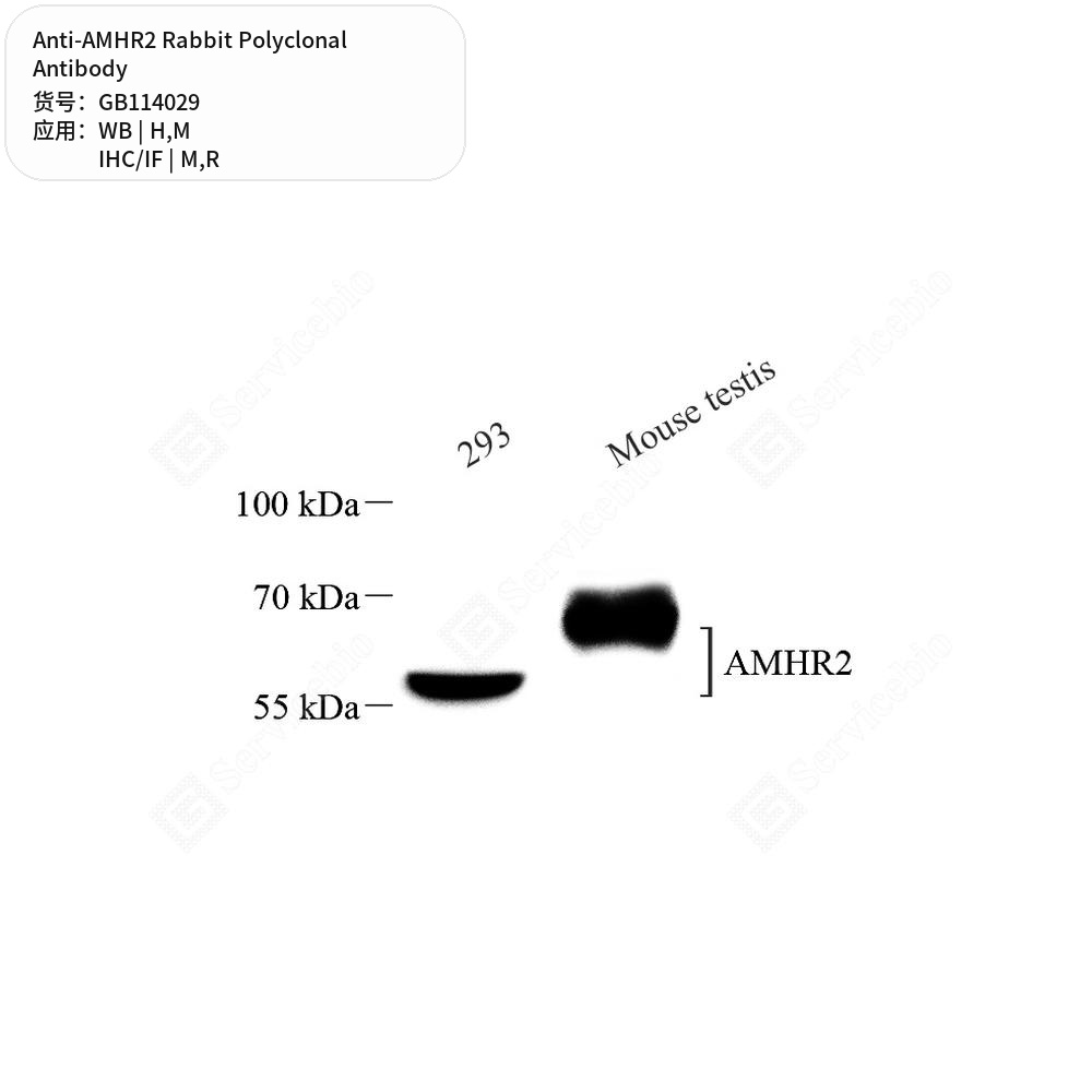Антитела первичные, поликлональные кролика к AMHR2 крысы, мыши, человека, 50 мкл