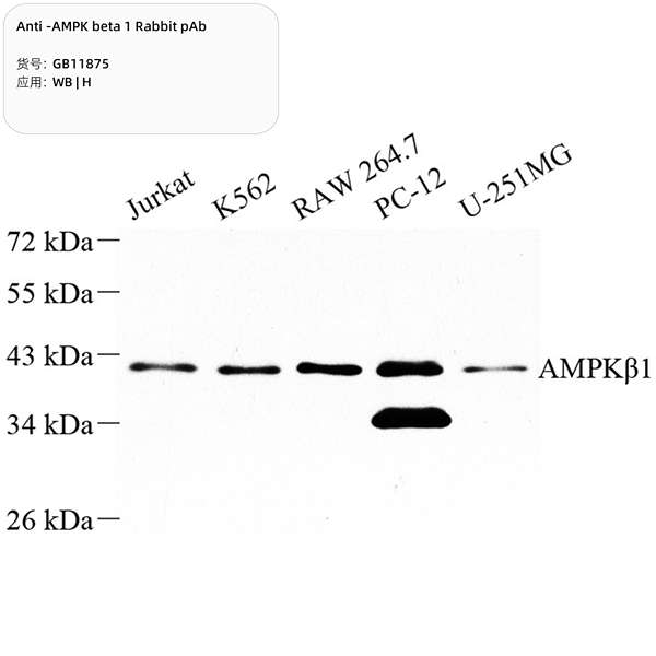 Антитела первичные, поликлональные, AMPK beta 1, 100 мкл