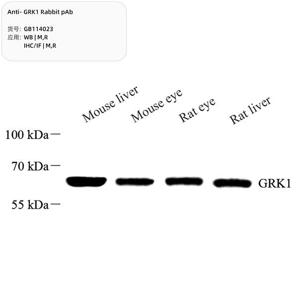 Антитела первичные, поликлональные, GRK1, 100 мкл