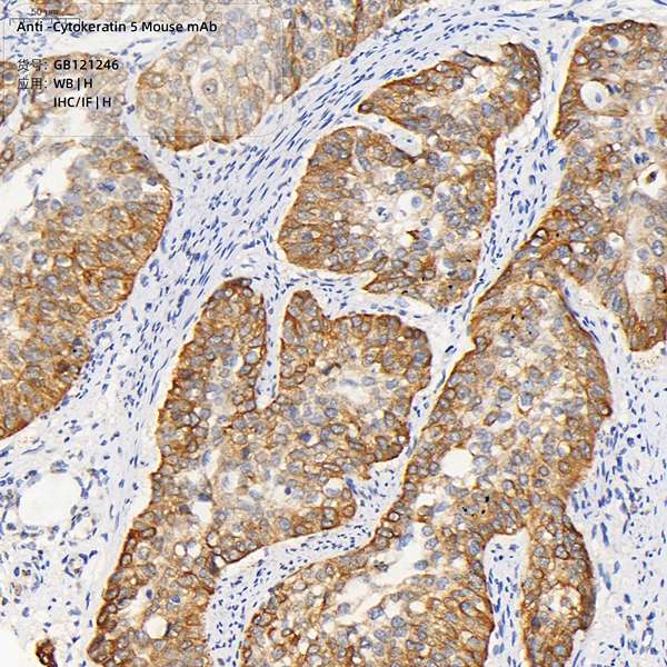 Антитела первичные, моноклональные, Cytokeratin 5, 100 мкл