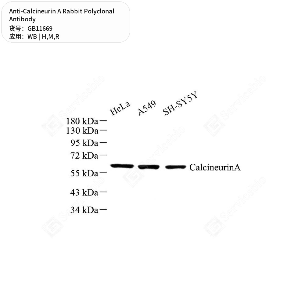 Антитела первичные, поликлональные кролика к Calcineurin A крысы, мыши, человека, 50 мкл