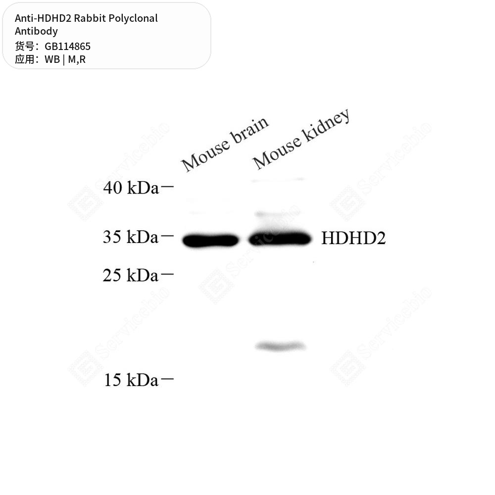 Антитела первичные, поликлональные кролика к HDHD2 крысы, мыши, 50 мкл