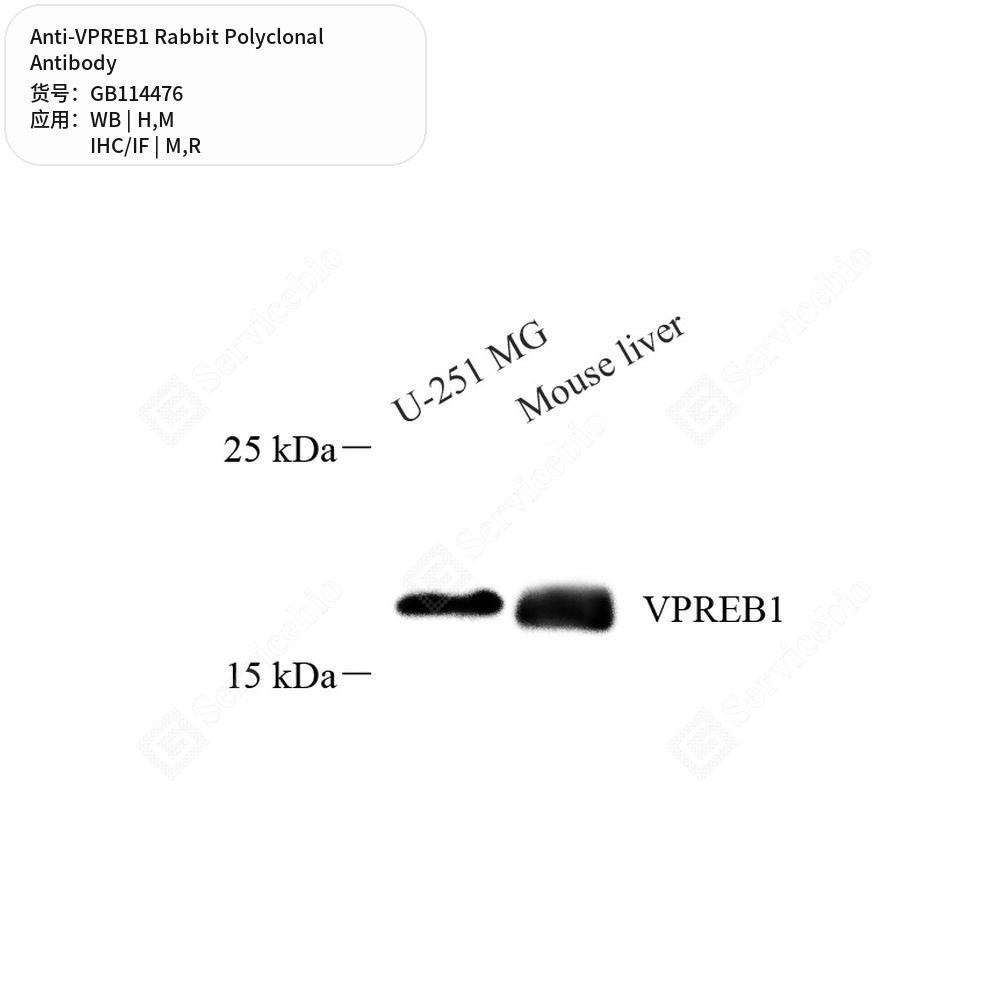 Антитела первичные, поликлональные кролика к VPREB1 крысы, мыши, человека, 50 мкл