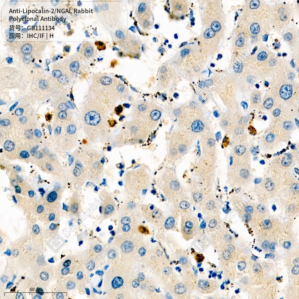 Антитела первичные, поликлональные кролика к Lipocalin-2/NGAL человека, 100 мкл