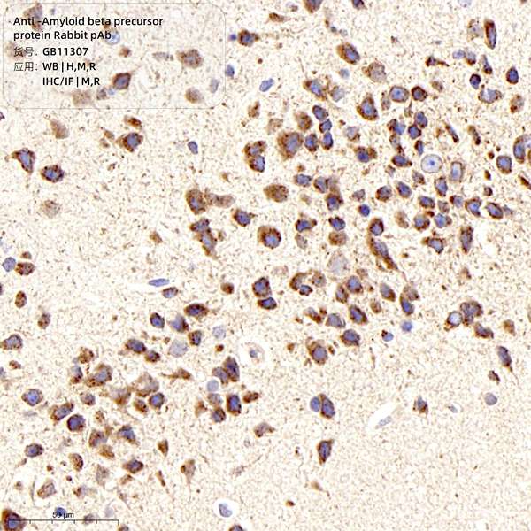Антитела первичные, поликлональные, Amyloid beta precursor protein, 100 мкл