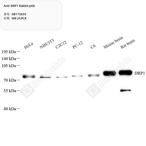 Антитела первичные, поликлональные, DRP1, 100 мкл