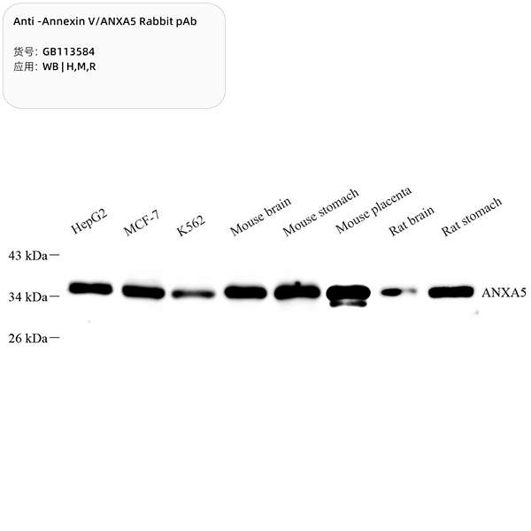 Антитела первичные, поликлональные, Annexin V/ANXA5, 100 мкл