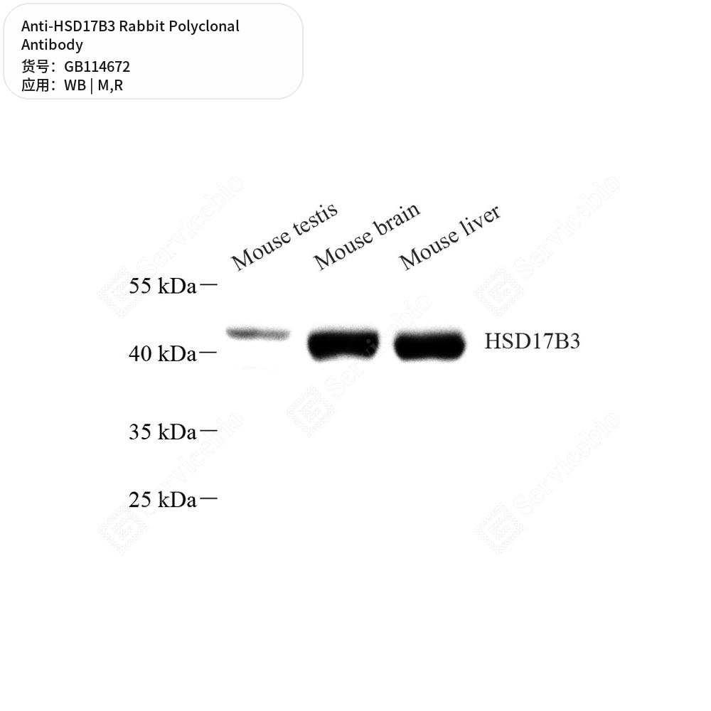 Антитела первичные, поликлональные кролика к HSD17B3 крысы, мыши, 100 мкл