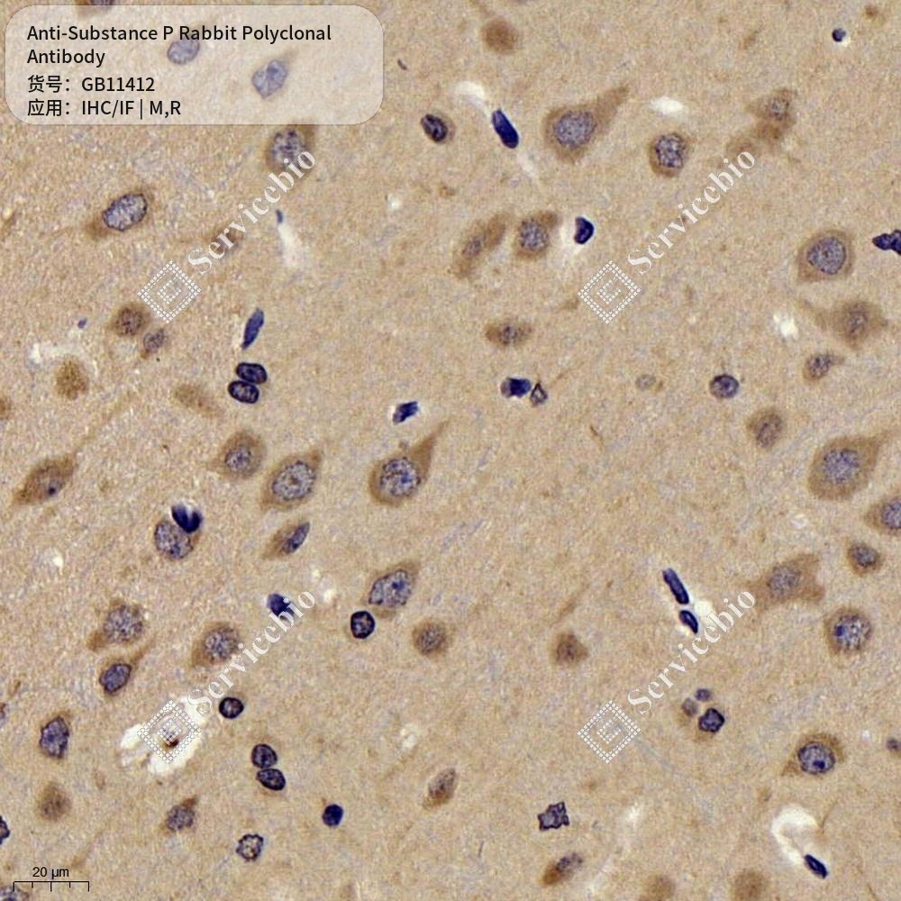 Антитела первичные, поликлональные кролика к Substance P крысы, мыши, 100 мкл