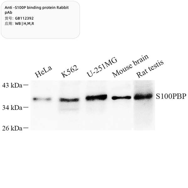 Антитела первичные, поликлональные, S100P binding protein, 100 мкл