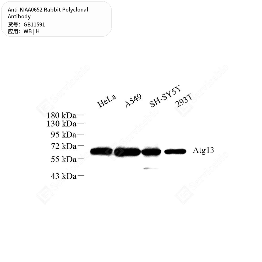 Антитела первичные, поликлональные кролика к KIAA0652 человека, 50 мкл