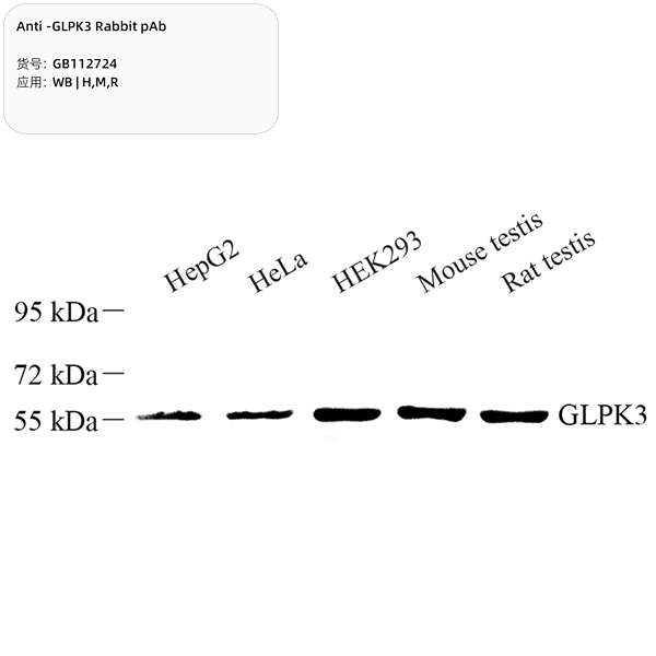Антитела первичные, поликлональные, GLPK3, 100 мкл