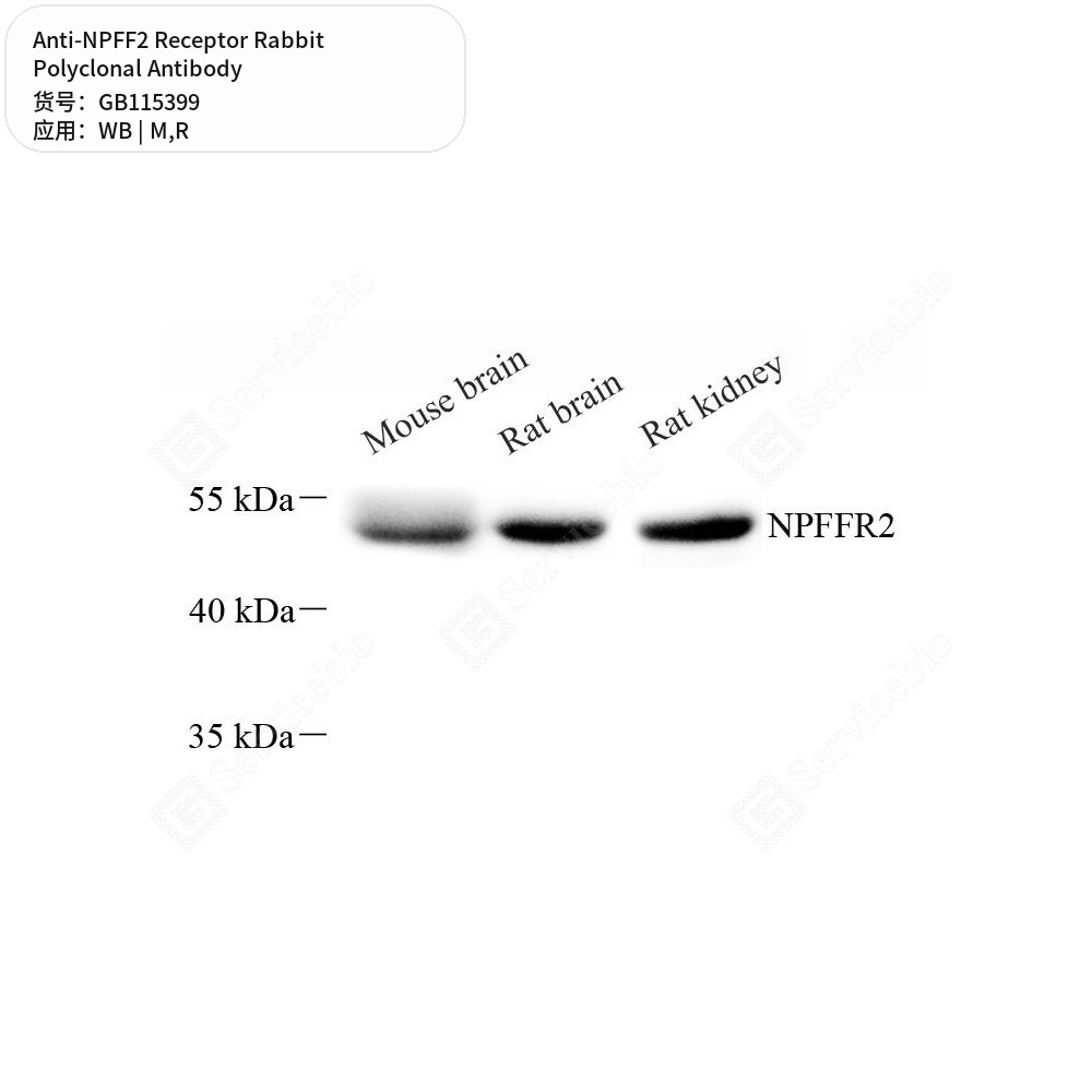Антитела первичные, поликлональные кролика к NPFF2 Receptor крысы, мыши, 50 мкл