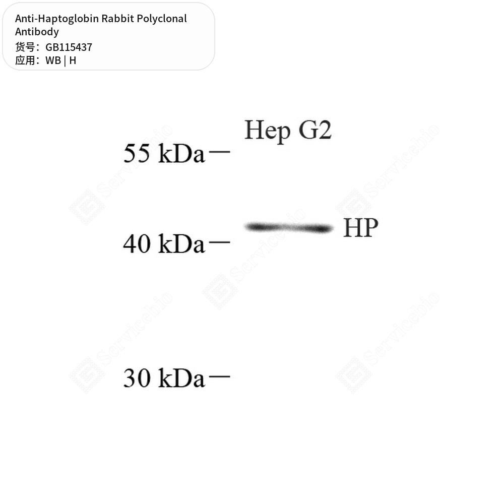Антитела первичные, поликлональные кролика к Haptoglobin человека, 100 мкл